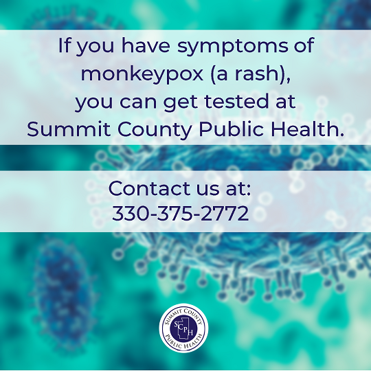 Monkeypox Summit County Public Health